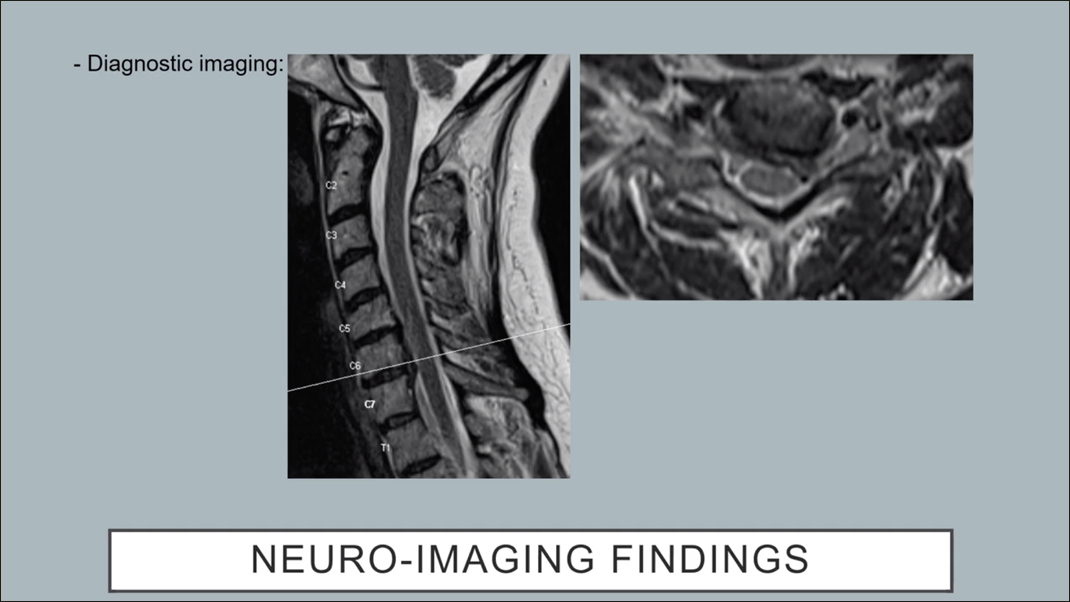 Housing and Travel Information – Spine Summit 2024